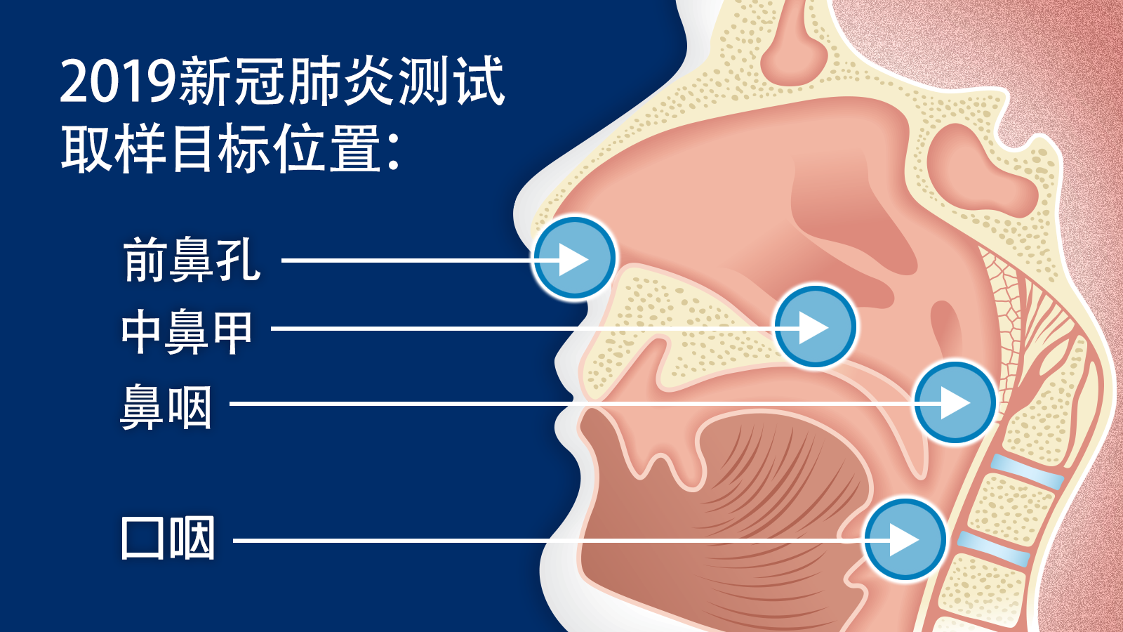2019新冠肺炎测试取样目标位置：前鼻孔, 中鼻甲, 鼻咽, 口咽