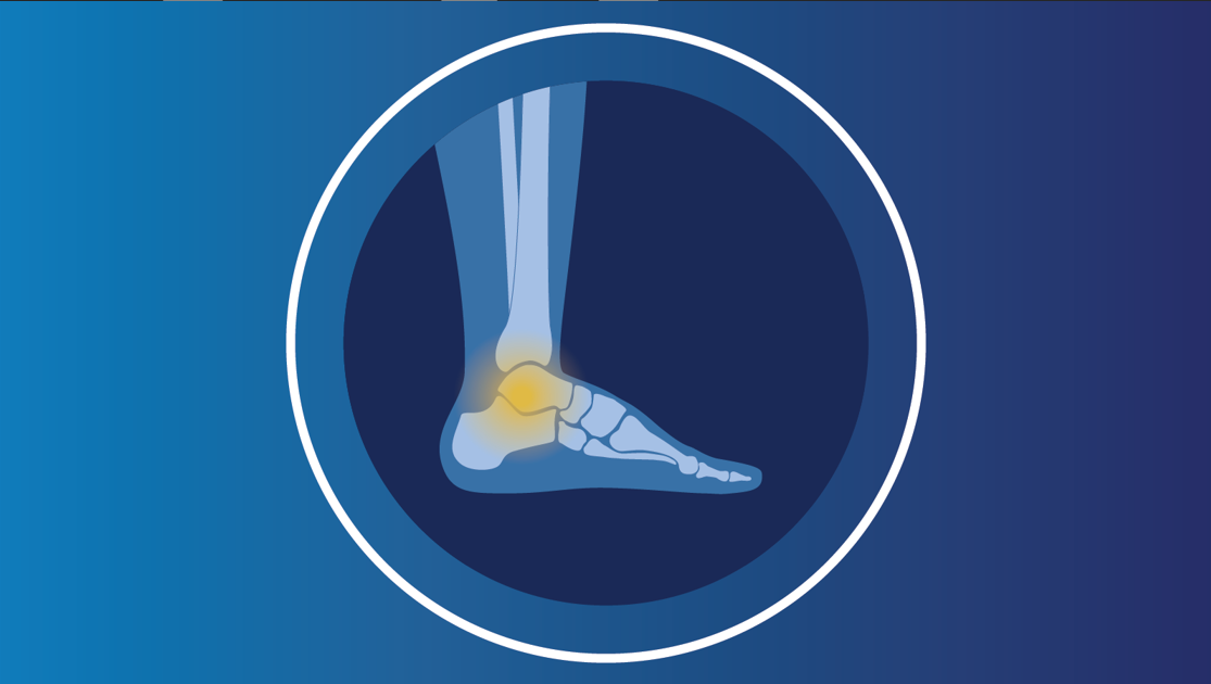 Illustration of an ankle.