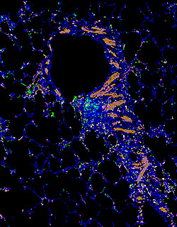 SARS-CoV-2-infected lung tissue, imaged using viralMIBI. (Image: Stanford)