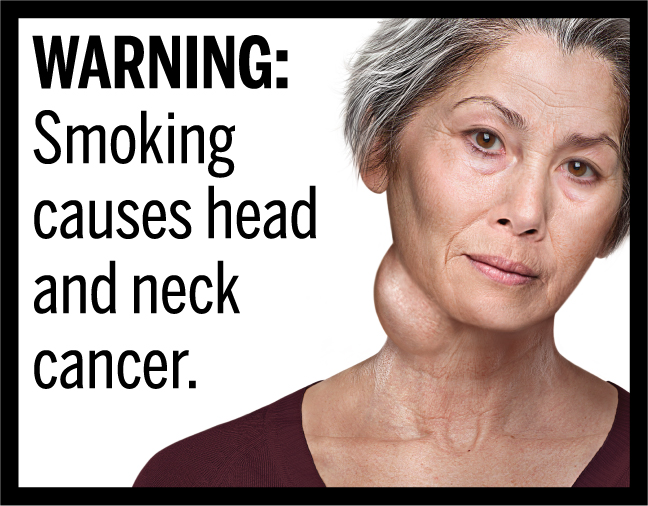 WARNING: Smoking causes head and neck cancer.