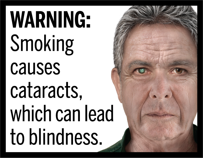 WARNING: Smoking causes cataracts, which can lead to blindness.