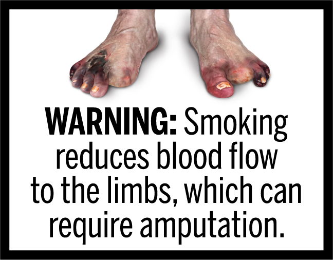 WARNING: Smoking reduces blood flow to the limbs, which can require amputation.
