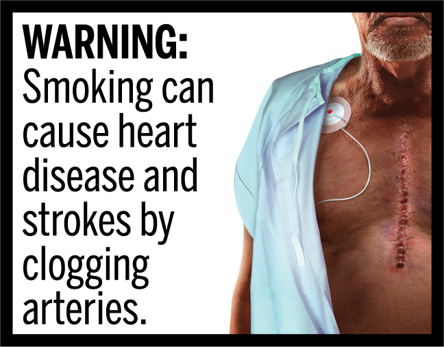 WARNING: Smoking can cause heart disease and strokes by clogging arteries.
