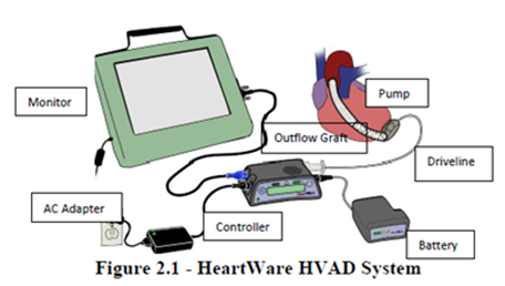 HeartWare HVAD System and components