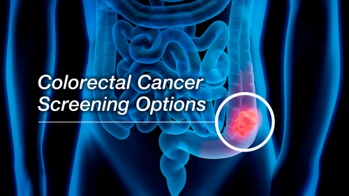 Blue X-ray image of a colon with the words "Colorectal Cancer Screening Options"  in the foreground.