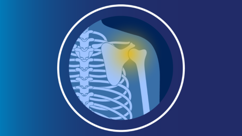 Illustration of a shoulder as part of the skeletal system.