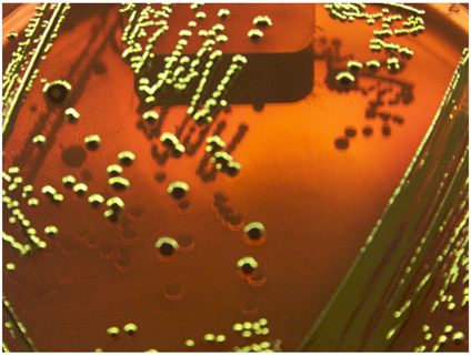 E. coli colonies on L-EMB agar_ucm173510.png