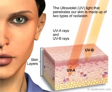 Diagram. The Ultraviolet (UV) light that penetrates our skin is made up of two types of radiation, UV-A rays and UV-B rays. Diagram shows UV-B rays penetrating the top layers of skin, while UV-A rays penetrate deeper. Image copyright medmovie.com.