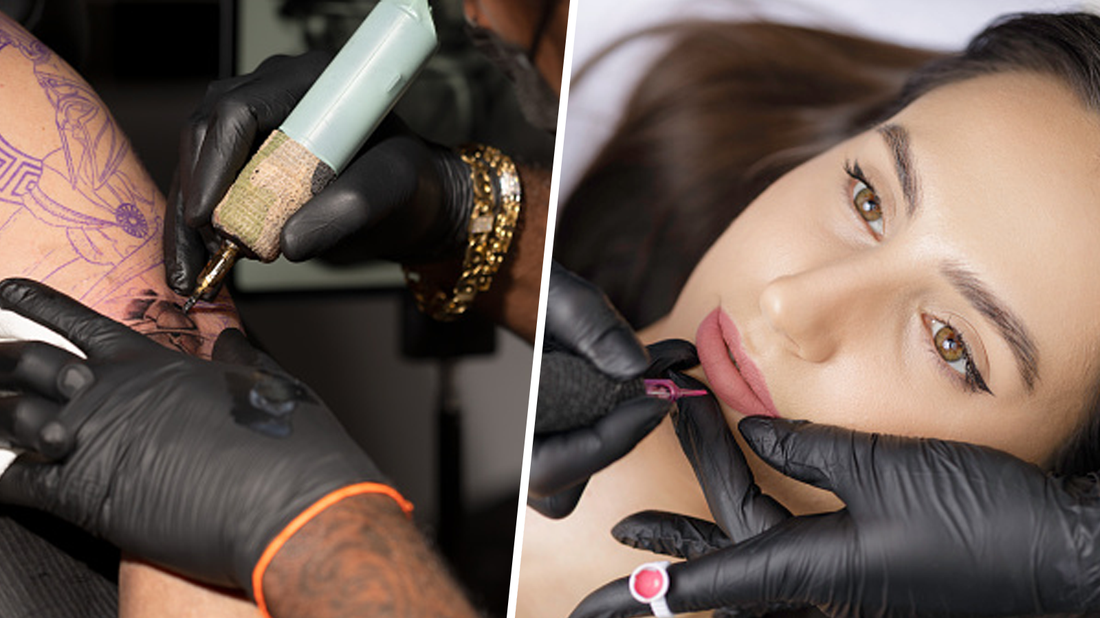 Infected Tattoo Stages Signs of Infection from Tattoos and After Tattoo  Removal  Removery