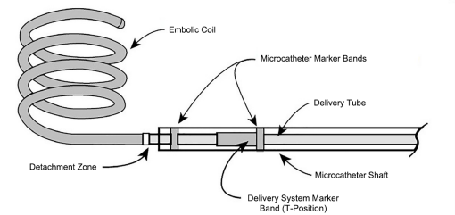 CEREPAK Detachable Coil System