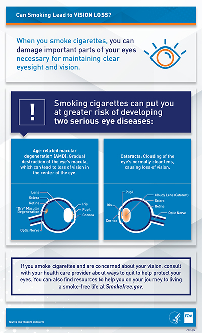 CTP - Can Smoking Lead to Vision Loss - TERL