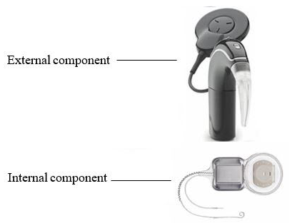 Photo of Nucleus 24 Cochlear Implant System – P970051/S205