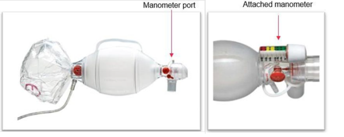 Ambu SPUR II Resuscitator showing the manometer port and attached manometer.