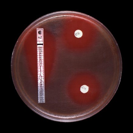 Results for two types of Results for two types of antibiotic susceptibility tests are shown in this image, a gradient diffusion test and a disk diffusion test to determine the antimicrobial susceptibility of group-B strep.  are shown in this image, a gradient diffusion test and a disk diffusion test to determine the antimicrobial susceptibility of group-B strep. 
