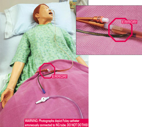 Foley catheter erroneously connected to NG tube on a mannequin in hospital bed.