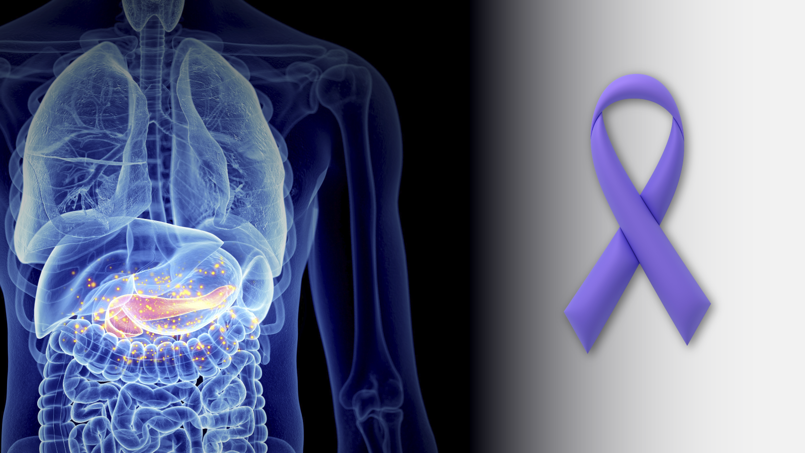 First in Class Targeted Therapy Approved for Common Form of Pancreatic Cancer 