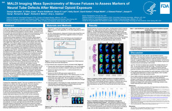 Poster Image - High resolution MALDI imaging mass spectrometry to assess spatial lipidomics of mouse fetal neural tube defects after maternal opioid exposure
