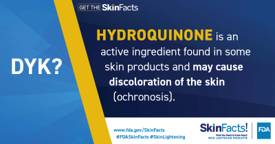 Hydroquinone is an active ingredient found in some skin products and may cause discoloration of the skin (ochronosis). 