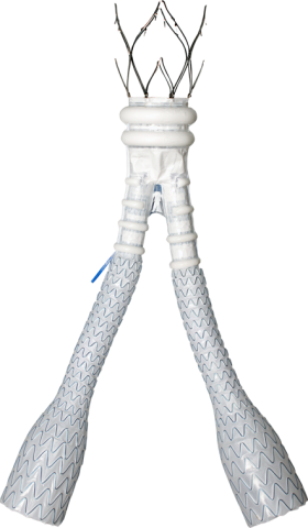 Alto™ Abdominal Stent Graft System – P120006/S031 | FDA