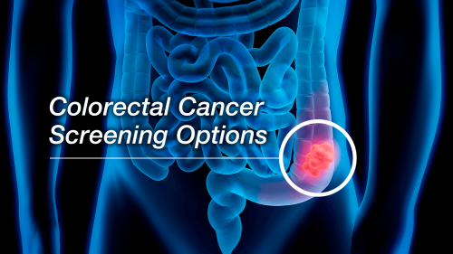 Screening Colonoscopy Plano