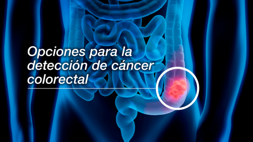 X-ray illustration of digestive and colon area of body. Colon area highlighted with text "Colorectal Screening Options"