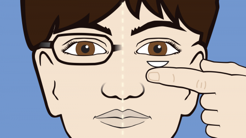 split screen illustration of youth appearing to be wearing glasses on one side of his face while a hand is about to put a contact lens into the other eye 