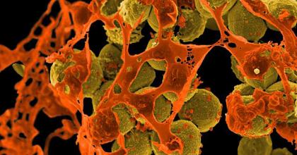 Scanning electron micrograph of methicillin-resistant Staphylococcus aureus (MRSA, brown) surrounded by cellular debris. MRSA resists treatment with many antibiotics. Credit: NIAID