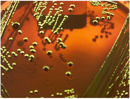 Bam Chapter 4a Diarrheagenic Escherichia Coli Fda