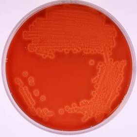 Bam Chapter 4a Diarrheagenic Escherichia Coli Fda