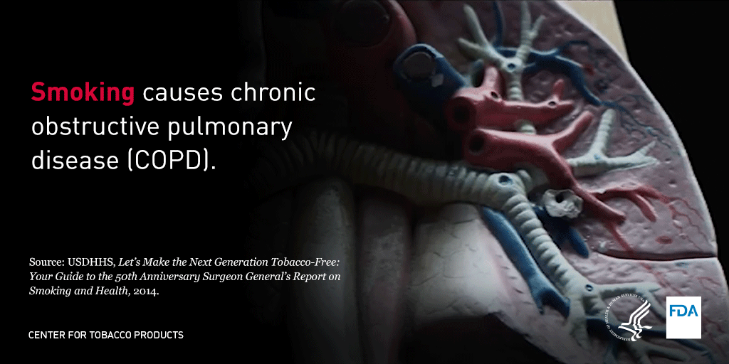 Tobacco For Smoking In Form Of Human Lungs Cigarettes Addiction To Smoking Harm Of Tobacco