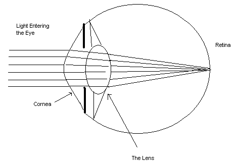 Graphic depicting a normal eye