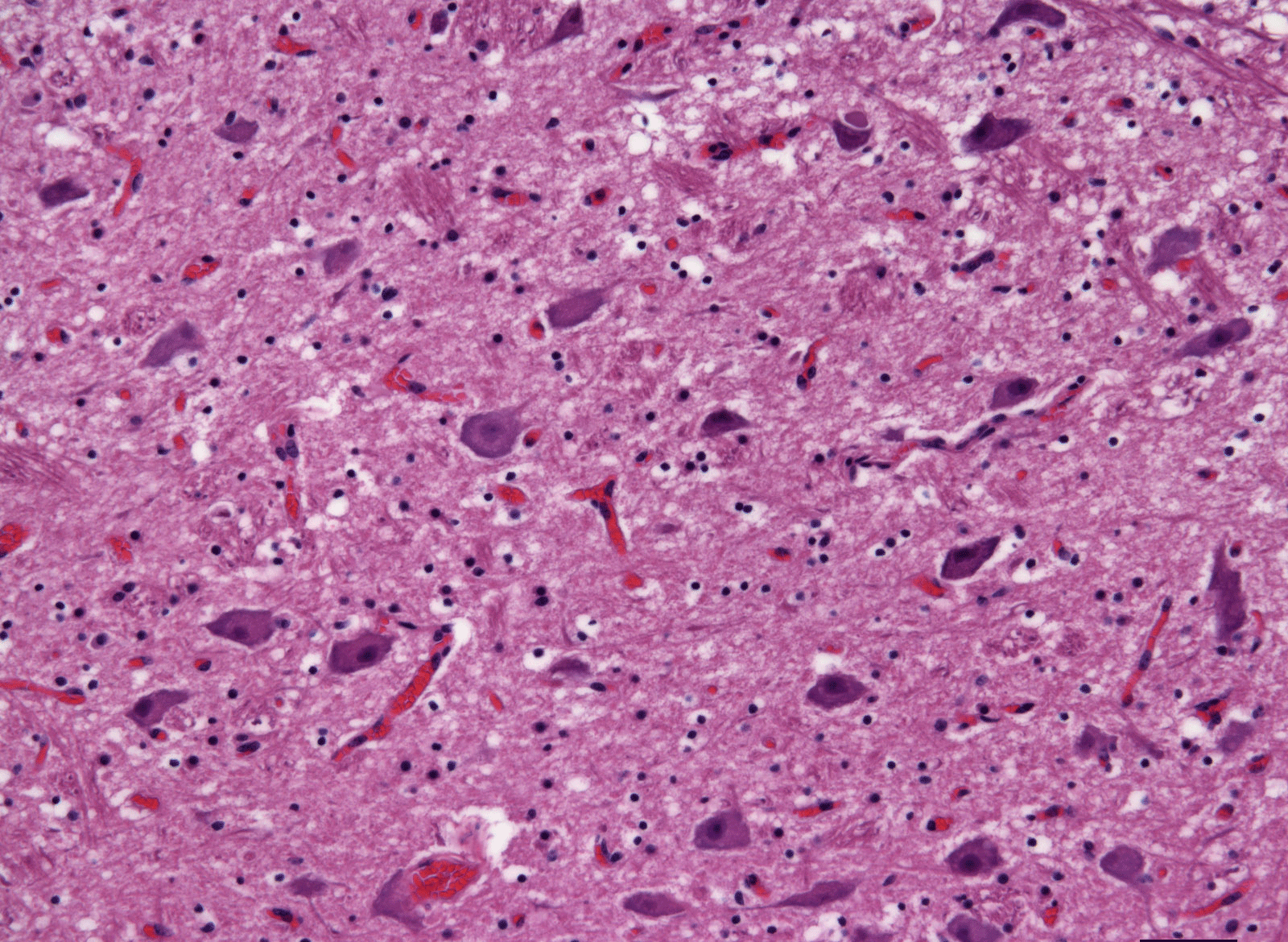 slide of cow brain - healthy cow