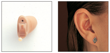 Fits Completely in the Canal Hearing Aid