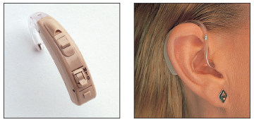Behind-the-Ear Hearing Aid