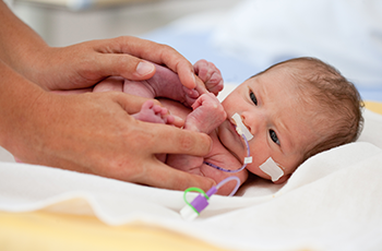A newborn premature infant receiving care in a hospital