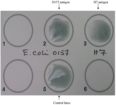 latex agglutination result_ucm173509.png