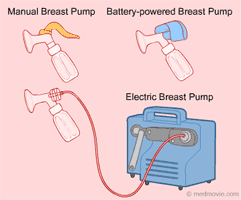 Picture depicting manual, battery-powered, and electric breast pumps