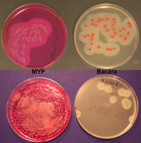 4 Petri dishes with titles demonstrating the difference in colony appearance when bacteria are grown on MYP medium (other organisms can grow) versus Bacara medium (other organisms inhibited)